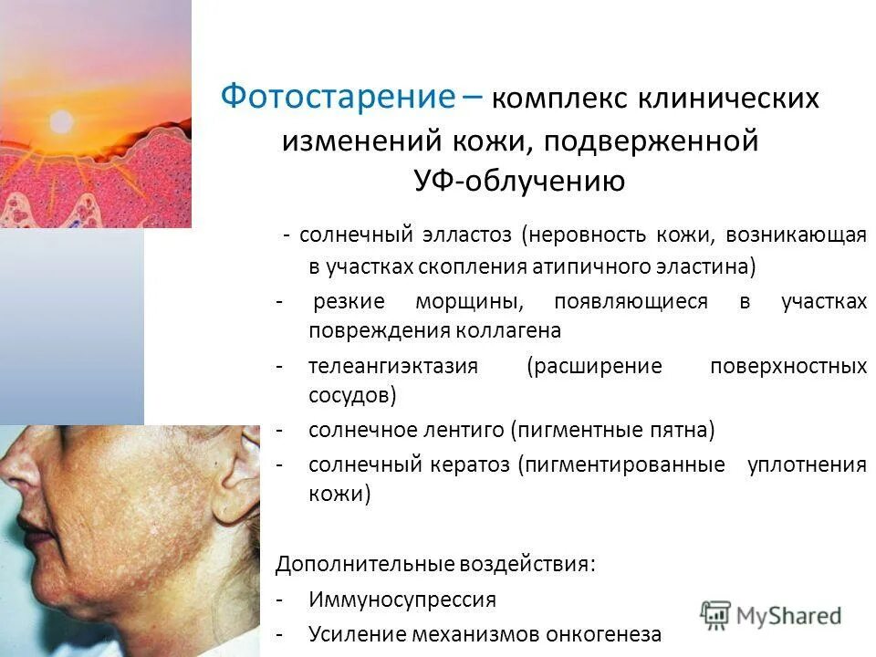 изменения организма при старении. изменения организма при старении. изменения организма при старении. физиология старческого возраста. старость это процесс.