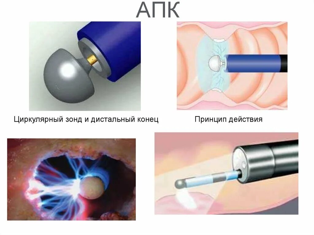 Зонд принцип. Дистальный конец зонда. Дистальный конец трубки. Дистальный конец катетера. Дистальный подвижный конец эндоскопа.