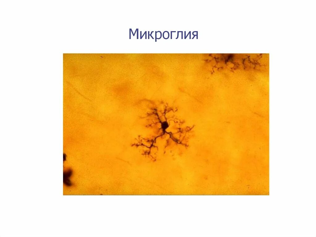 Клетки микроглии функции. Микроглия в нервной ткани. микроглия препарат. микроглия гистология. микроглия клетки.
