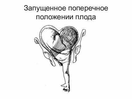 Положение 21