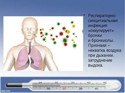 Синцитиальная инфекция