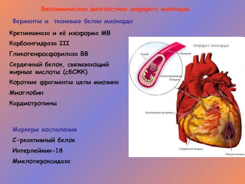 Белки миокарда. Белки инфаркта миокарда. Сердечный белок. Аномалии сердечно-сосудистой системы.