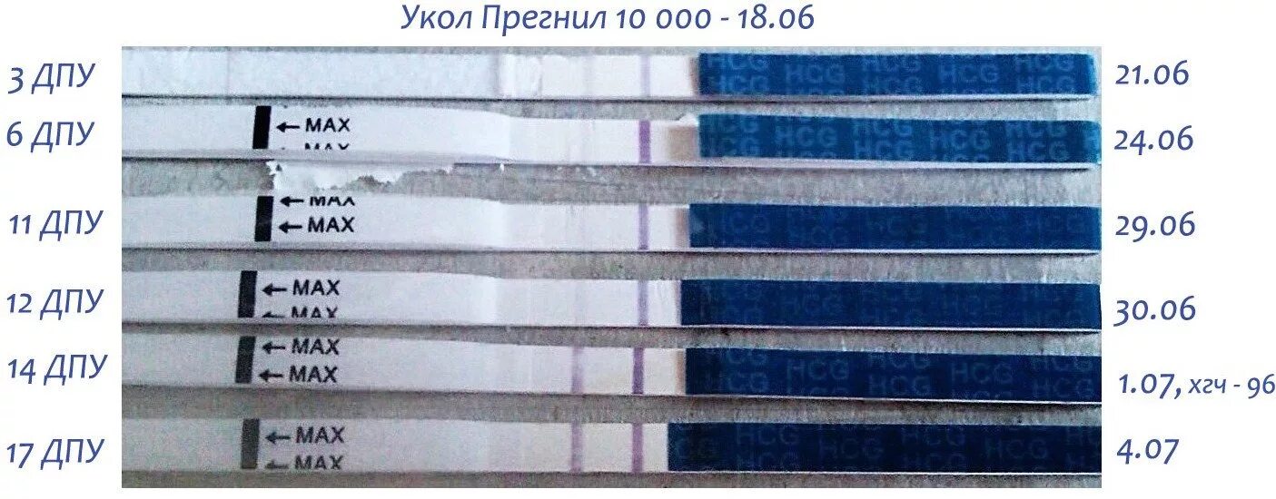 Беременность после хгч форум. Тест на беременность после укола хгч. тест на беременность после укола хгч 10000. хгч после укола 10000. тест на беременность на 7 день после укола хгч.