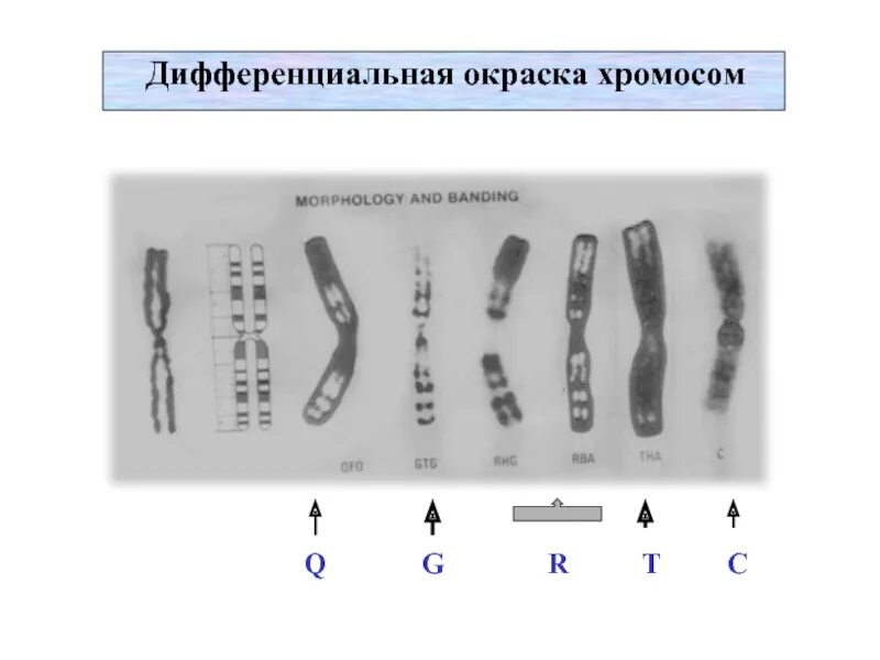 Изменение окраски хромосом. Методы дифференциальной окраски хромосом. Кариотип методом дифференциальной окраски хромосом. Q метод окрашивания хромосом. R метод окрашивания хромосом.