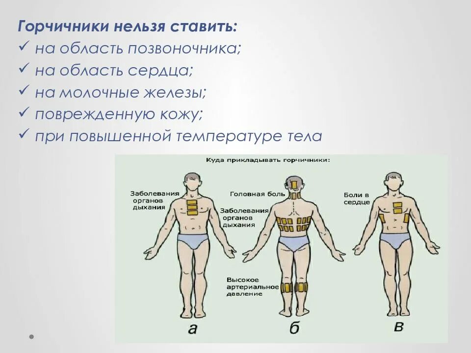 Сколько можно ставить горчичники взрослому. Места наложения горчичников при кашле. Куда нельзя накладывать горчичники. Куда ставить горчичники. Кудамтавить горчичники.