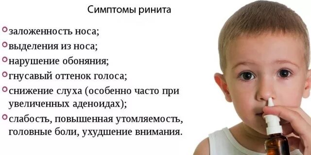 Задний насморк. Острый гринарт у ребенка. насморк у детей симптомы. острый ринит у детей клиника. клинические проявления острого ринита у детей.