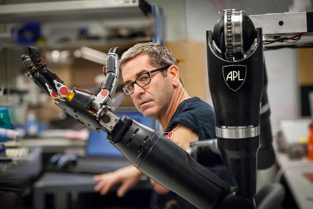 Arm engineering