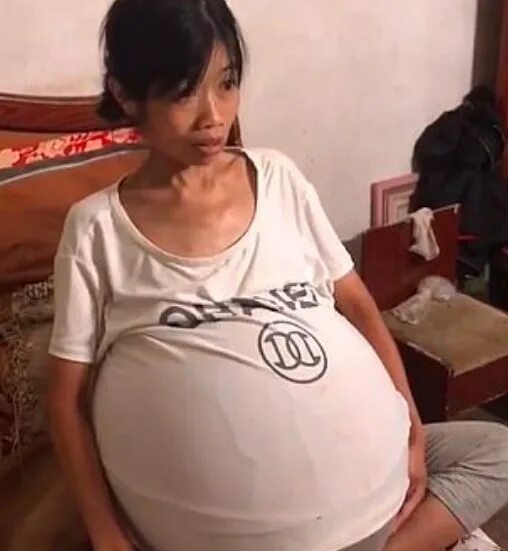 Опущенный живот при беременности. Живот отпущен при беременности. Опустившийся живот перед родами. Опущение живота перед родами. Опущение живота беременной.