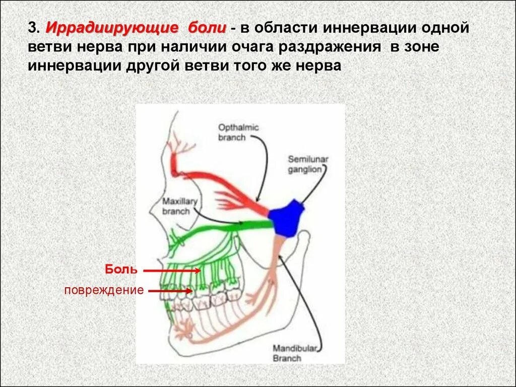 Иррадиация боли. Патогенез иррадиирующей боли. Иррадиирующая боль физиология. Механизм иррадиации боли.