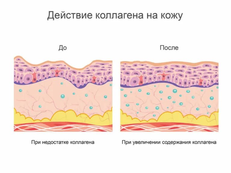 Схема выработки коллагена. Действие коллагена. Недостаток коллагена в коже. Выработка собственного коллагена.