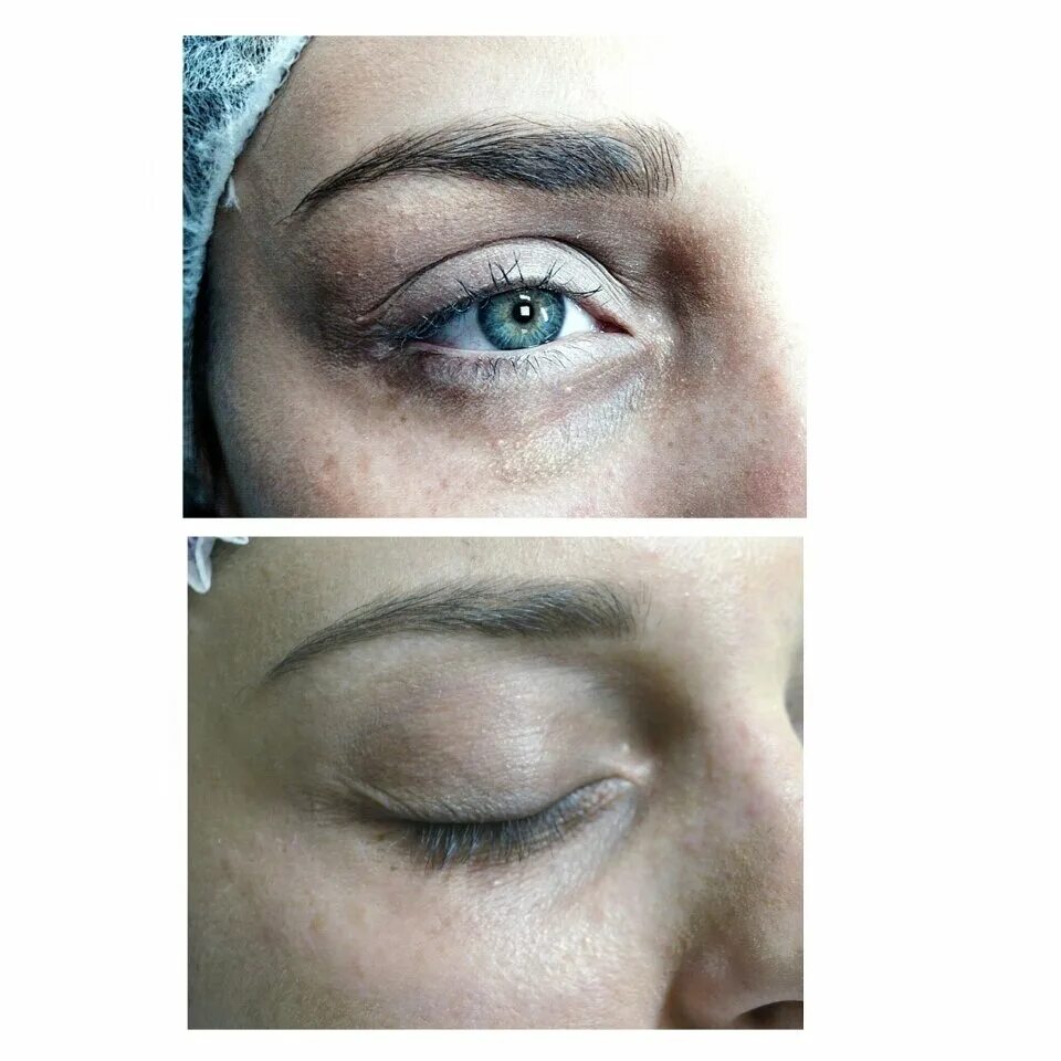 Зажившие пудровые брови. Камуфляжный перманентный макияж. Перманентный макияж под глазами. Перманентный макияж камуфляж. Татуаж темных кругов под глазами.
