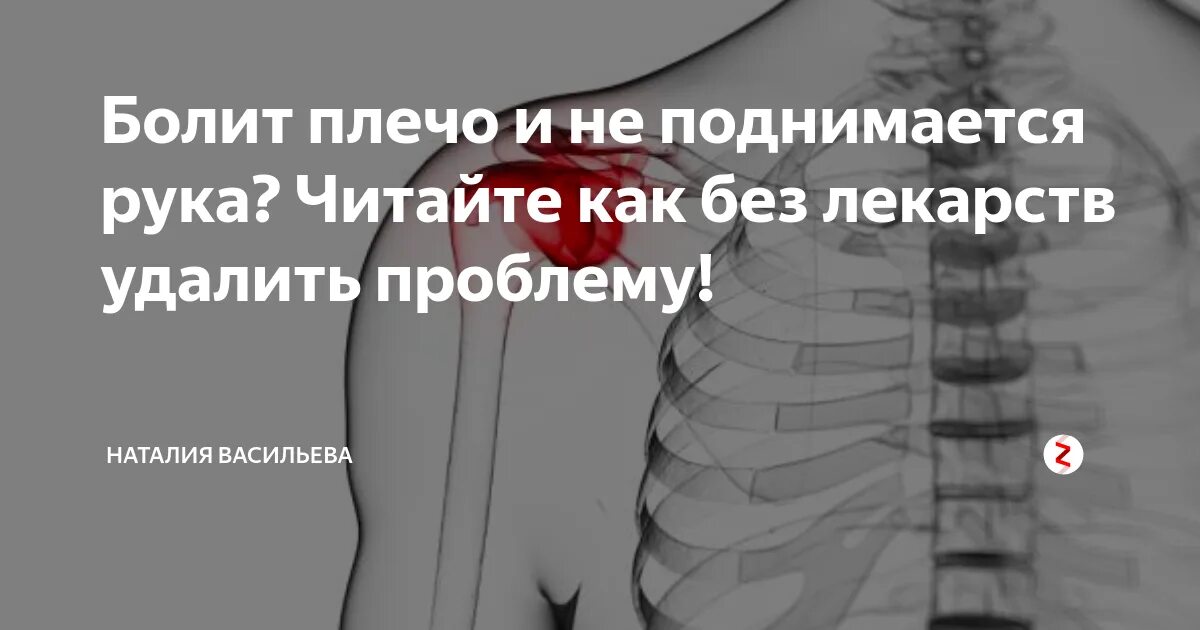 Боль в руке при поднятии и отведении. Болит плечо. Болит плечо левой руки. Болит плечевой сустав левой руки.