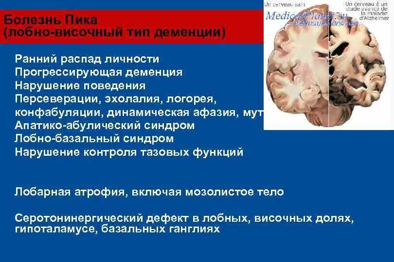 Распад симптомы