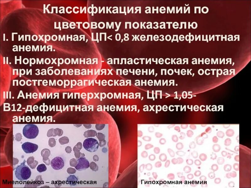 Гиперхромная анемия классификация. Классификация анемий гипохромные гиперхромные. Апластическая анемия гиперхромная. Апластическая анемия нормохромная.