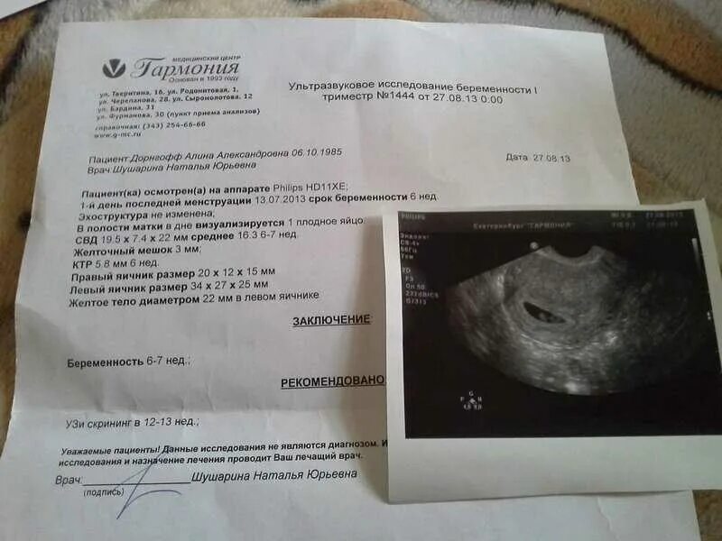 Беременность 4 недели что происходит симптомы. Узи беременности на ранних сроках 6 недель. ультразвуковое исследование при беременности раннего срока. замершая беременность узи. узи две недели беременности.