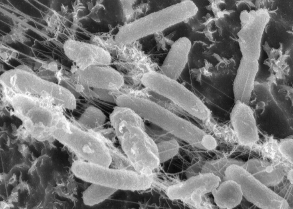 Под каким микроскопом можно увидеть бактерии Bacteria Cells Gram Positive Cocci in Chain . Stock Photo Image of computer, b