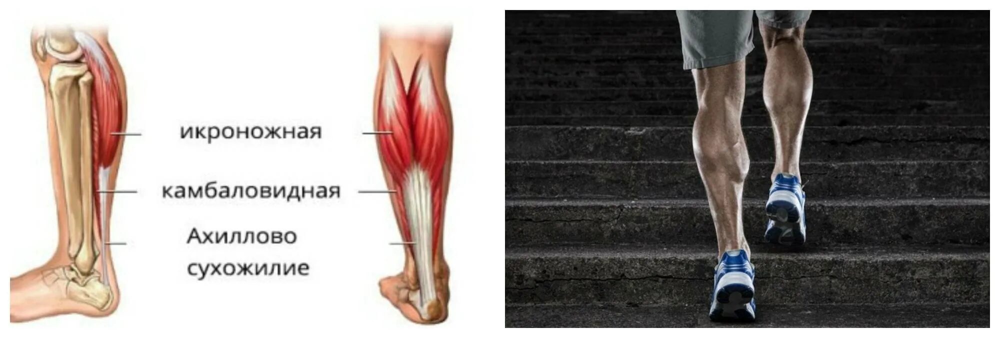 Почему болят сухожилия на ногах. Сухожилия икроножной мышцы анатомия. Икроножная и камбаловидная мышцы. Медиальная головка икроножной мышцы анатомия. Икроножная мышца голени.