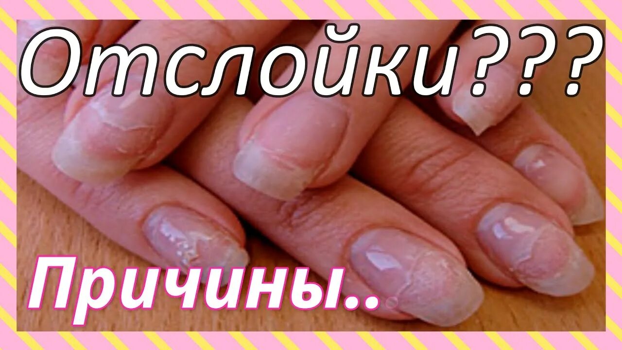 Почему отслойка на свободном крае. Отслойки гель лака. отслойка покрытия на ногтях. отслойки на ногтях гель лака. отслойка гель лака от ногтя.