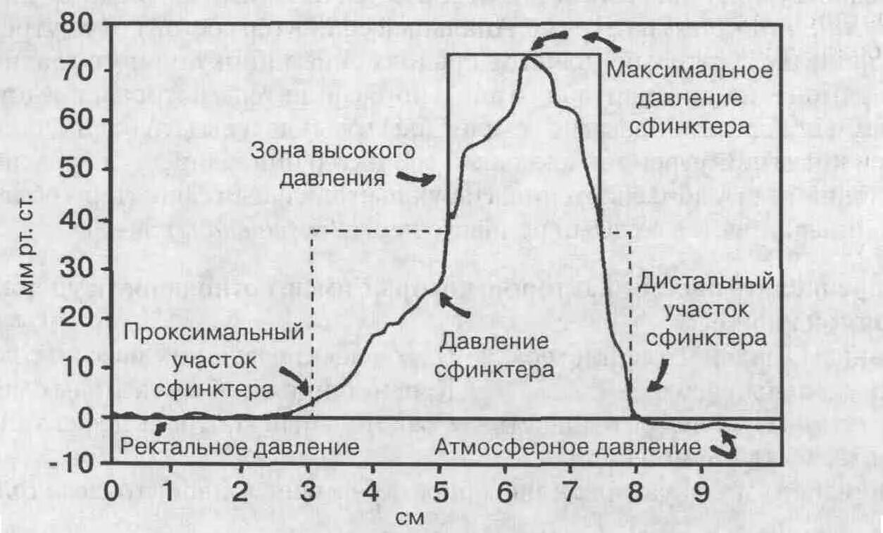 Сфинктерометрия норма.