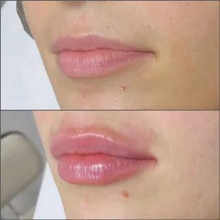 Коррекция половых