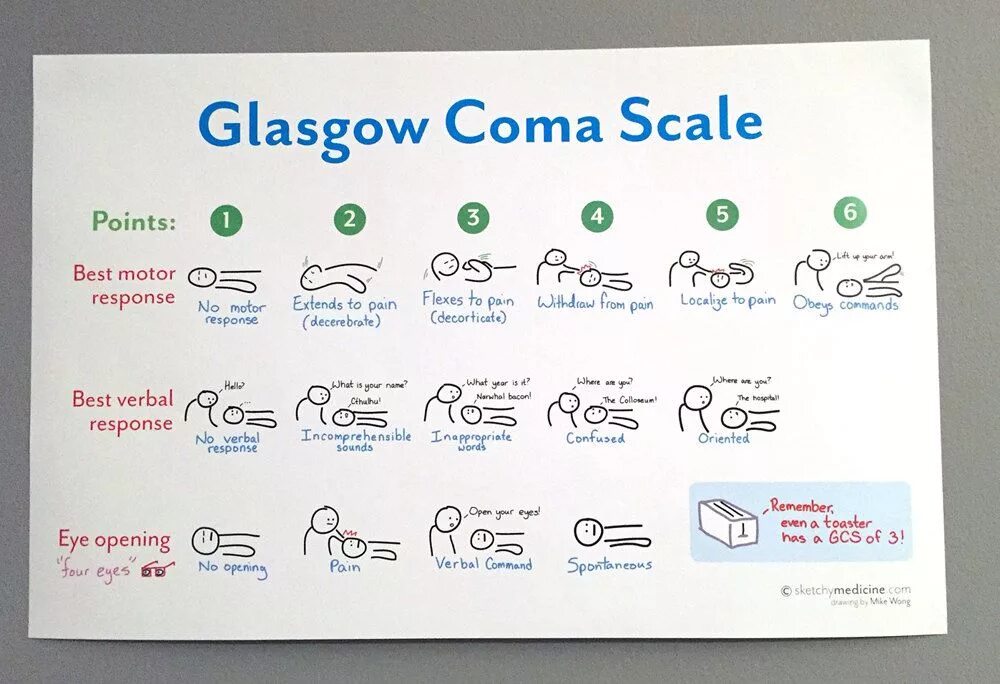 GCS. Glasgow Scale. Coma Glasgow. Come Glasgow Scale. Glasgow перевод