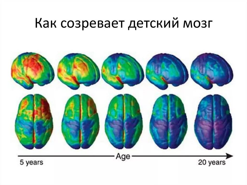 Развитие мозга возраст. Этапы созревания головного мозга. Возрастные этапы созревания мозга. Этапы созревания мозга у детей. Стадии развития мозга ребенка.