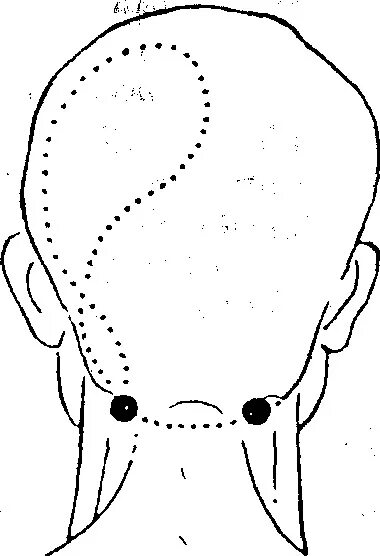 Точки на затылке. Акупунктурные точки при боли в голове. Точечный массаж головы. Точки на голове для массажа.