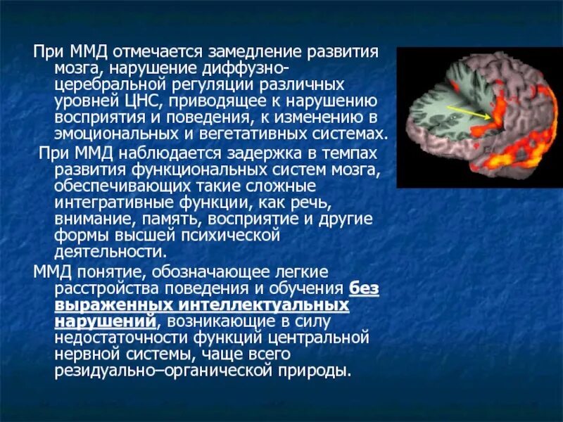 ММД минимальная мозговая дисфункция. Нарушение функций мозга. Минимальная дисфункция мозга у детей. Минимальная церебральная дисфункция.