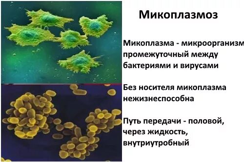 Микоплазма половым путем. Микоплазменная инфекция возбудитель. микоплазма внутриклеточный возбудитель. микоплазмоз клинические проявления.