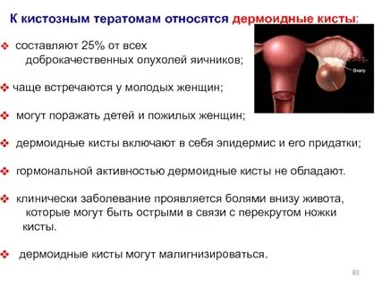 Код мкб киста правого яичника