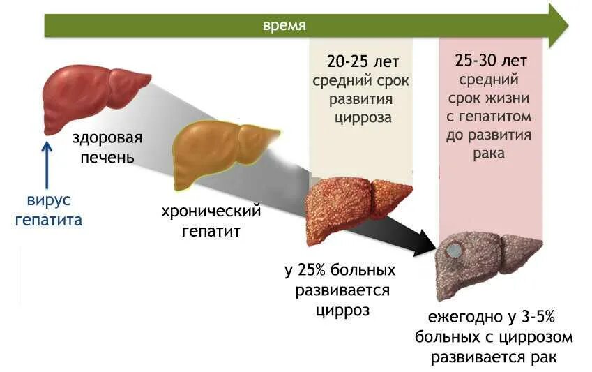 Д Ифузные изменения печени.