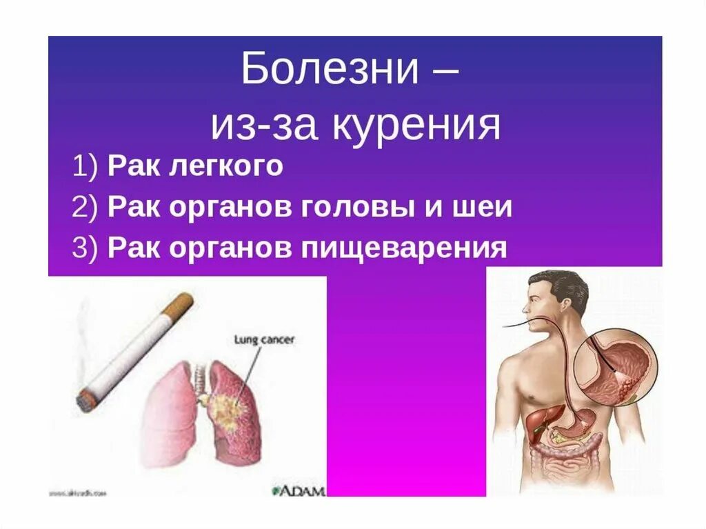 курить вредно. табакокурение и его влияние на здоровье. презентация о вреде курения. презентация курение и здоровье. кулить здоловью вледить.