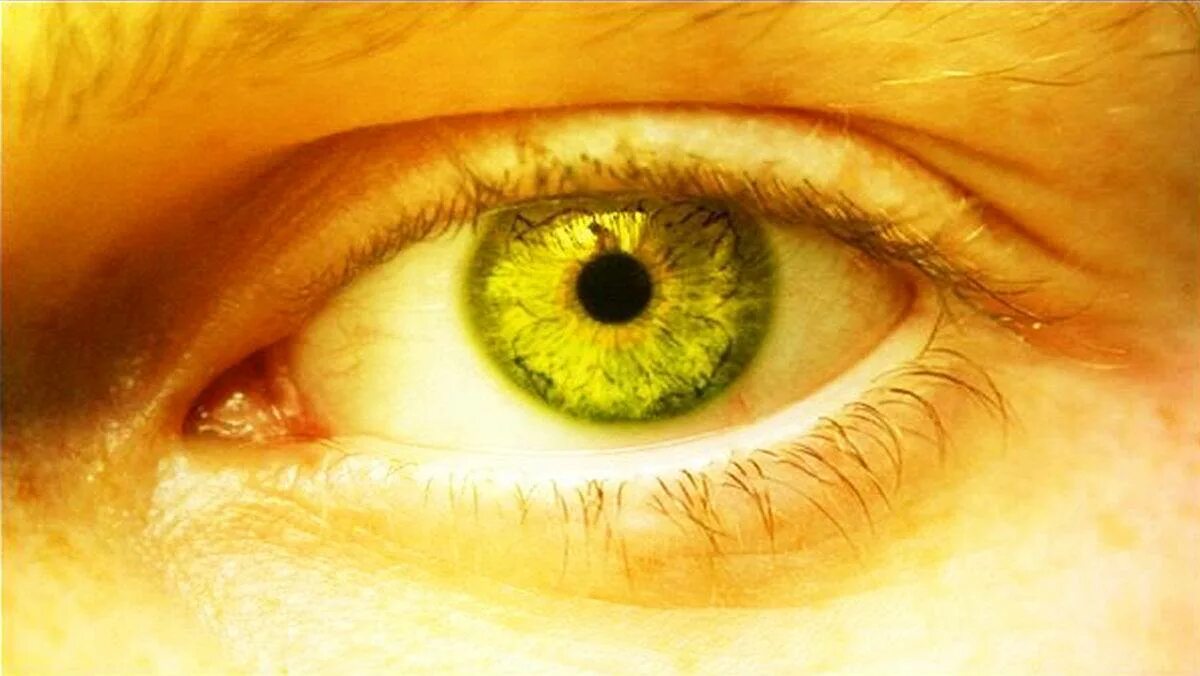 Желтый глаз 11