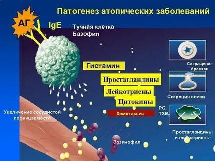 Атопические заболевания