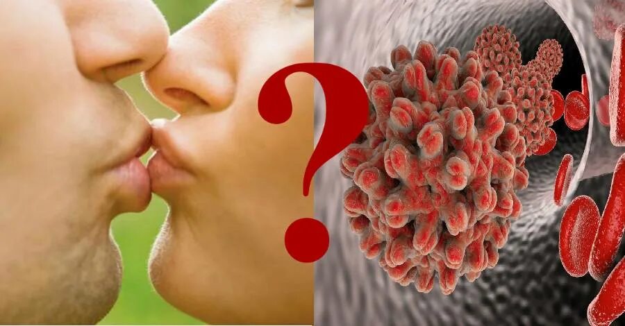 Вич при поцелуе. ВИЧ СПИД передается через поцелуй. Пути передачи ВИЧ через поцелуй. Инфекции через поцелуй. Гепатит с передается через поцелуй.