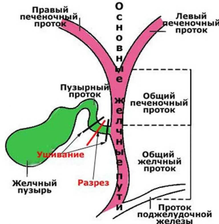 Удалить желчных протоков. Схема желчных протоков. протоки печени схема. схема движения желчи по желчным протокам. желчный пузырь и протоки строение.