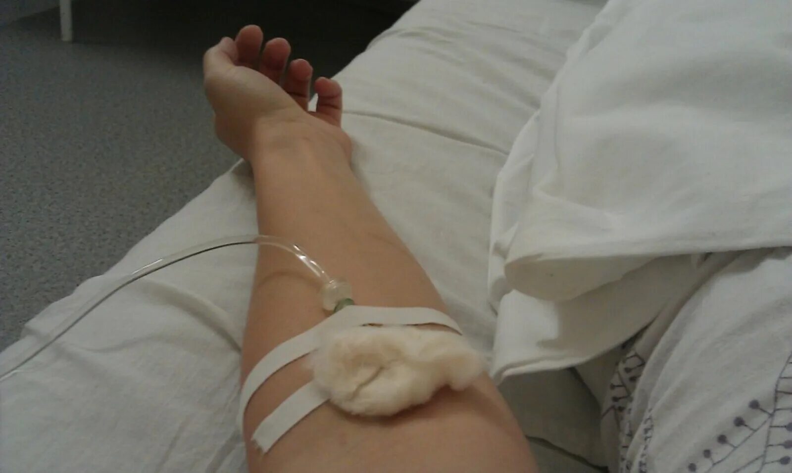 Рука девочки в больнице. Рука девочки в больнице. Рука девочки в больнице. Рука с капельницей в больнице. Молодые люди в больнице.