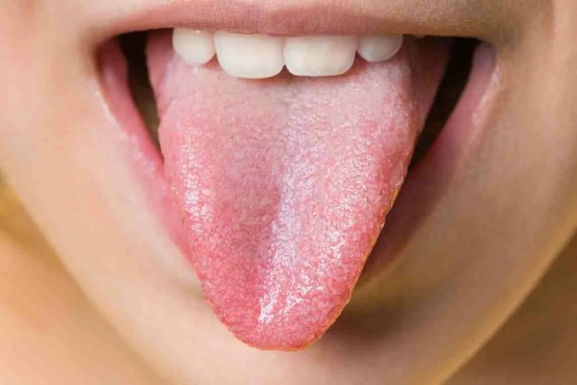 Что означает розовый язык. Гипертрофический глоссит. Цвет языка здорового человека.
