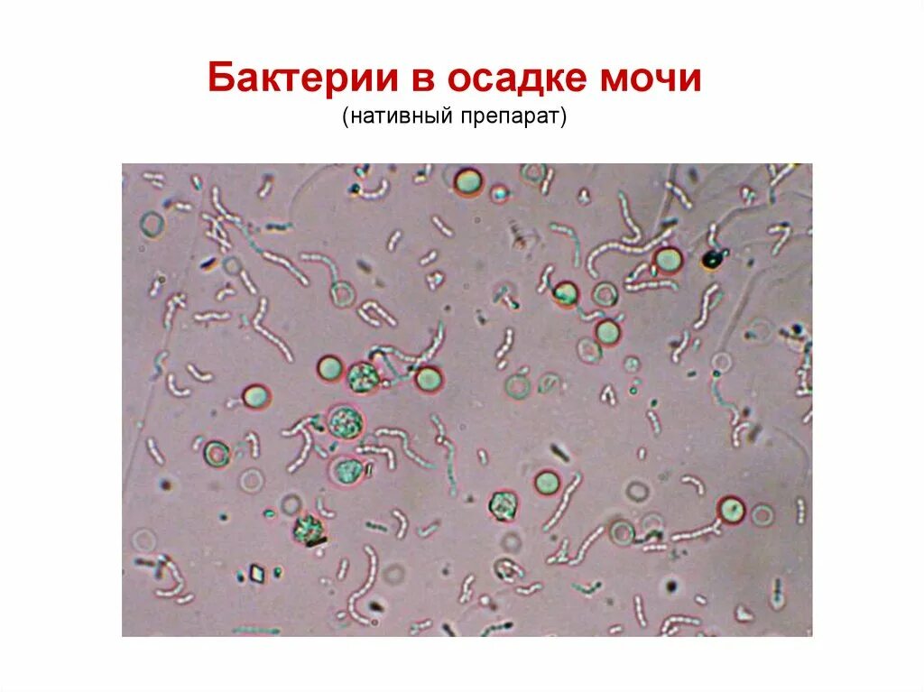 Бактерии в моче микроскопия осадка. Бактерии в моче при микроскопии. Бактерии в осадке мочи. Бактерии в моче под микроскопом.