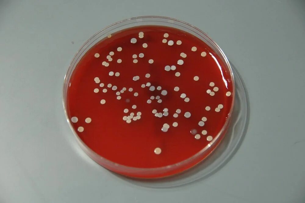 Микоплазма на чашке Петри. Чашка Петри с агаром. Колонии микоплазм на плотной питательной среде. Золотистый стафилококк на кровяном агаре. Staphylococcus aureus среда