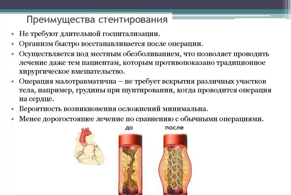 Терапия после стентирования. Лекарства после стентирования сосудов. препараты после стентирования коронарных артерий. стентирование сосудов при инфаркте. стентирование коронарных сосудов осложнения.