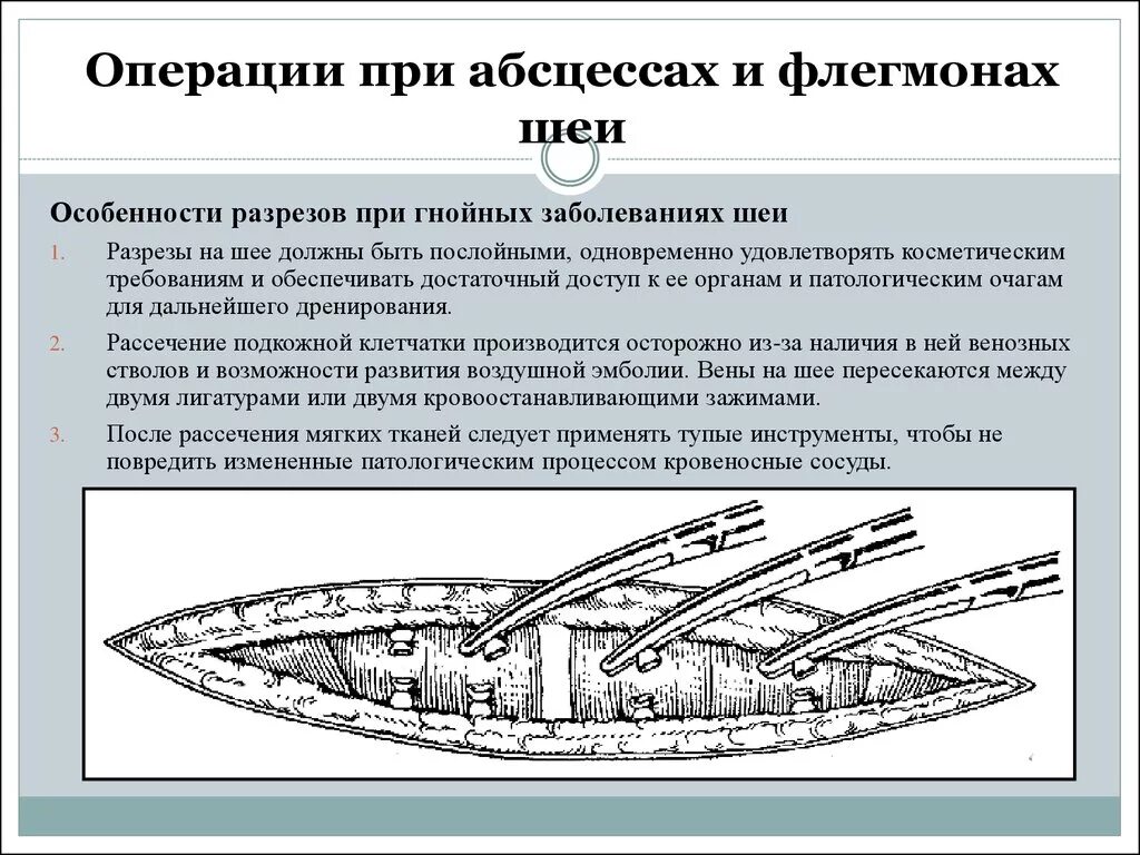 Операции при абсцессах и флегмонах шеи. Операции при флегмонах шеи. Разрезы для вскрытия флегмон шеи. Разрезы при гнойных процессах шеи.