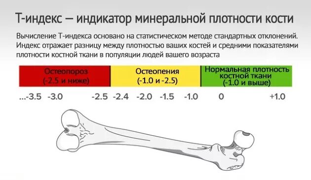 Плотность руки. Плотность человеческой кости. Определение плотности кости. Плотность костной ткани. Показатели плотности кости.