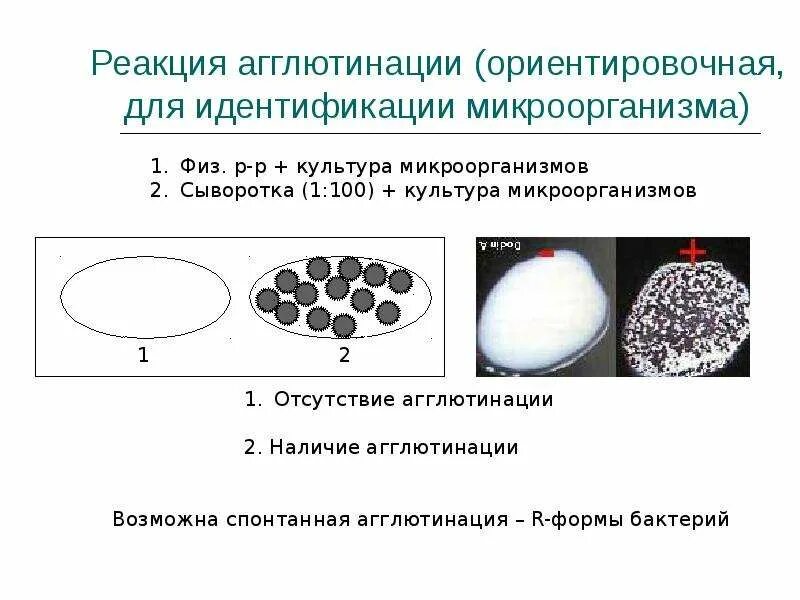 Реакция агглютинации реагенты. Реакция агглютинации механизм реагенты. ориентировочная реакция агглютинации микробиология. постановка ориентировочной реакции агглютинации. реакция агглютинации микробиология.