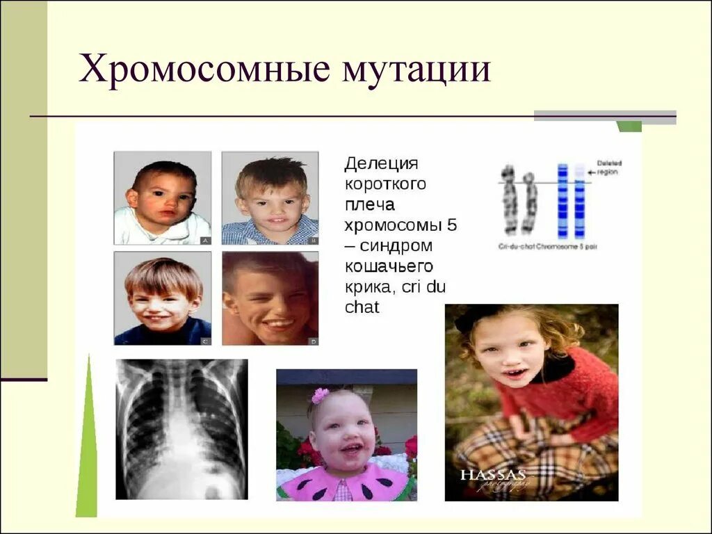 Болезни связанные с изменением хромосом. Генные хромосомные и геномные мутации. Хромосомные и геномные болезни человека. Делеции хромосомных мутаций. Хромосомные мутации дупликация.