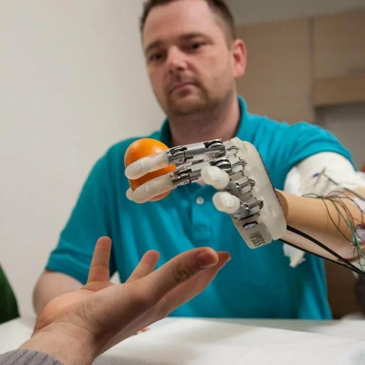 Протез бедра немодульный (пн6-36, пн6-35). Механический протез ноги. Типы съемных зубных протезов. Протезы голени в узбекистане. Протезирование на 3д принтере.