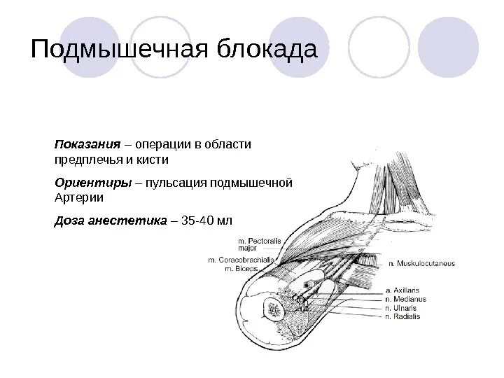 Блокада показания. Подмышечная проводниковая анестезия. Блокада локтевого нерва подмышечным доступом. Анестезия плечевого сплетения подмышечным доступом. Проводниковая анестезия подмышечным доступом техника.