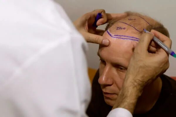 Пересадка 5 часов. Пересадка 5 часов. Пересаженные конечности. Пересадка 5 часов. Первая пересадка сердца человеку в мире.