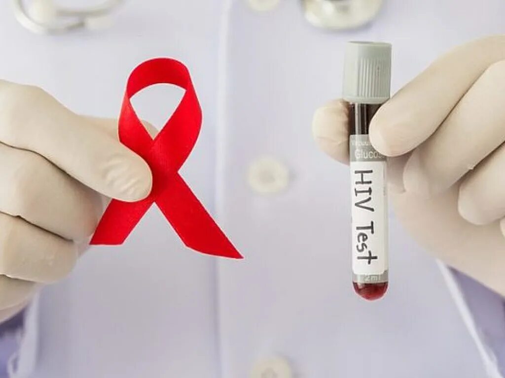 Личные вич. ВИЧ. ВИЧ инфекция. Тест на ВИЧ инфекцию. ВИЧ картинки.