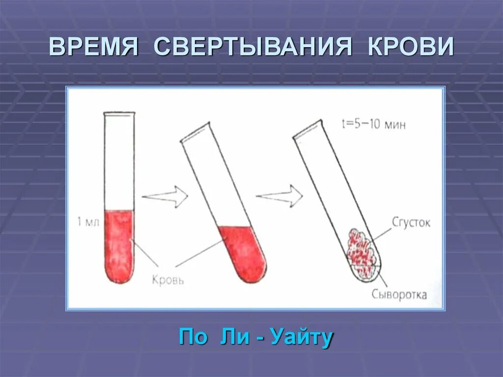 Свертывание крови тест. Время свертывания крови. Время свертывания крови по ли-Уайту. Методика определения времени свертывания крови. Свертывание крови по ли Уайту.